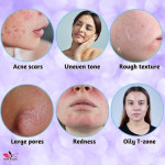 Bakuchiol by Shin Ryura Korea